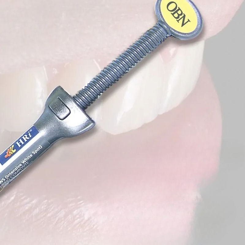 Materiali dentali Meisu Restau - Uv Resin recensione e prezzo